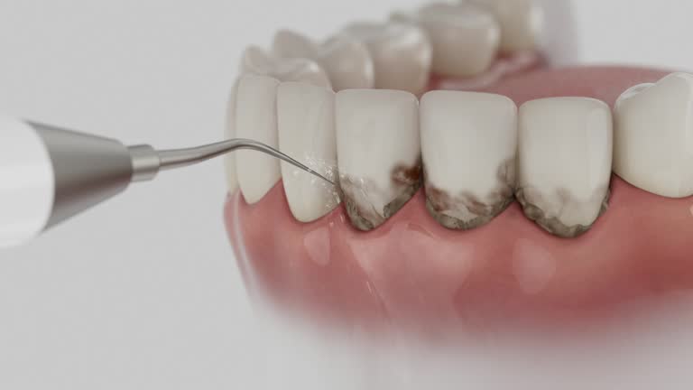 Trusted Dental Crowns And Bridges service in Celina, TX - Dentist Open Now